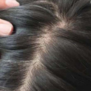 髪の毛の植毛:あり