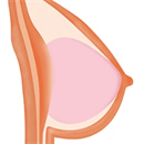 乳房タイプ:ゼリー胸