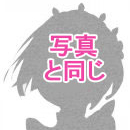 髪の毛の植毛:あり