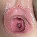 キャンペーン:膣の柔らか仕上げ
