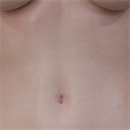 肌の色:ノーマル