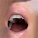 機能追加:ROS口腔