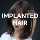 髪の毛の植毛:あり