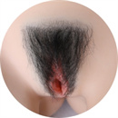 陰毛:植毛タイプ陰毛