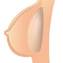 乳房タイプ:中空タイプ『大きい胸限定 』