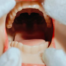 ヘッド柔らかさオプション:軟性シリコンヘッド+1.0 ROS口開閉機能