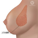 機能追加:リアル乳腺