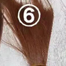 髪の毛の植毛:#6